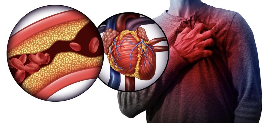 About Hypertension