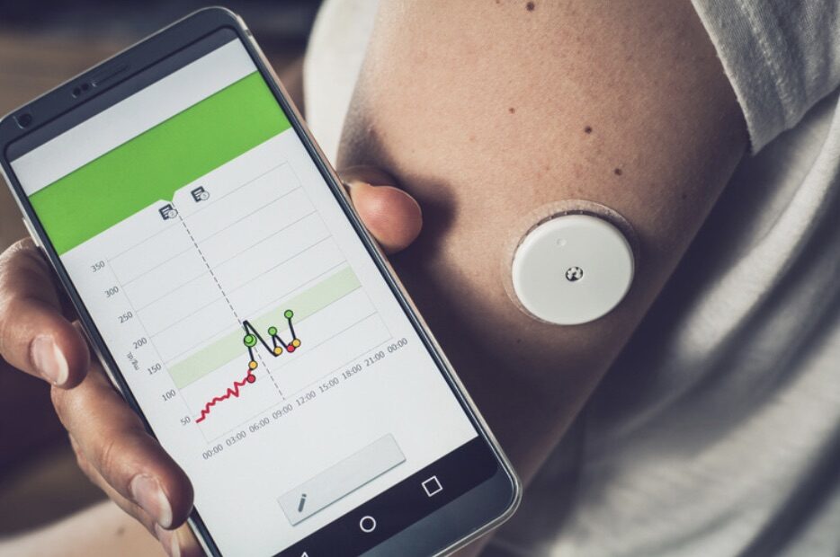 Continuous Blood Glucose Monitor